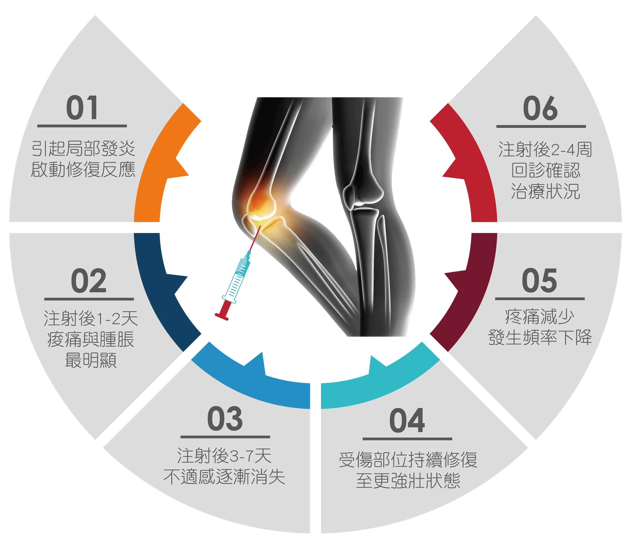 pac骨科術後復健